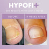 HypoFix™ Primer