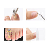 5pc Ingrown Toe Nail Set